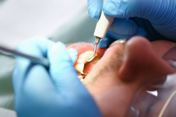 Best Chipped Tooth Repair Near Me  in Plainedge, NY