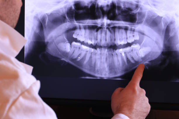 Best Chipped Tooth Repair Near Me  in Plainedge, NY